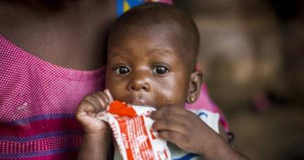 Pays-Bas - UNICEF : 6,7 millions d'enfants supplémentaires de moins de 5 ans pourraient souffrir d'émaciation cette année à cause de la COVID-19